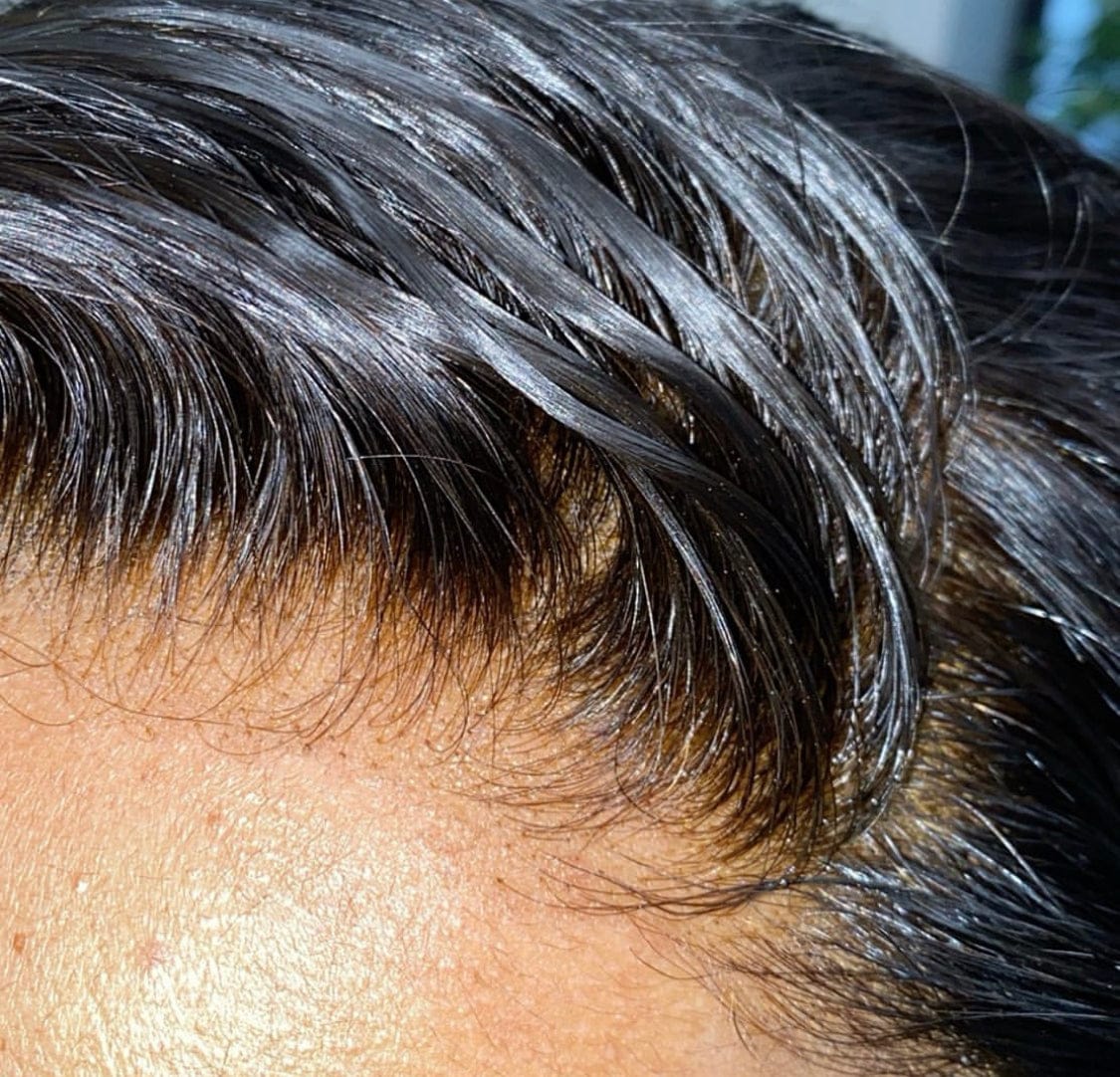 HD LACE CLOSURES - RAW VIRGIN HAIR
